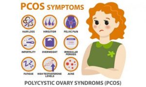 Polycystic Ovary Syndrome Symptom| Nepal Health Magazine